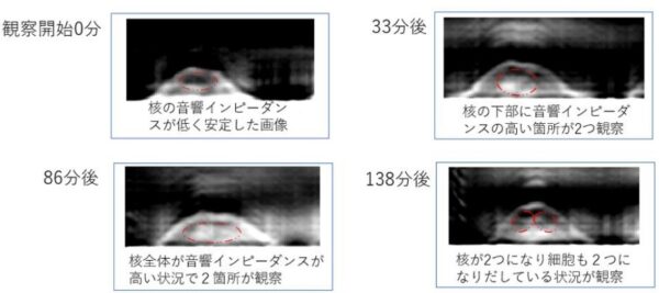 細胞分裂期の観察事例
